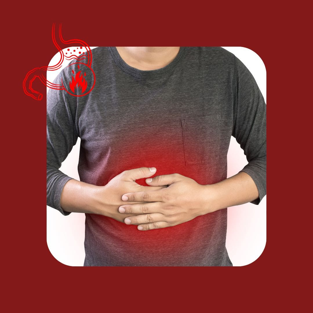 Gastroesophageal reflux disease (Acid reflux)